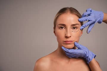 Blefaroplastia Inferior